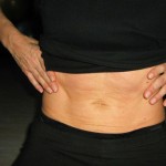 Colon irritabile sintomi: cosa c'è da sapere